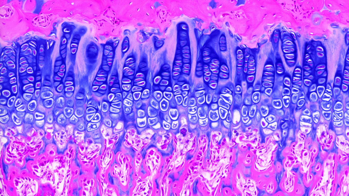 Cells in different stages of bone growth