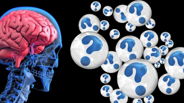 Brain Image Alzheimer's disease