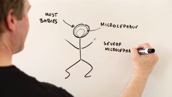 A screenshot of a whiteboard in a video on the Zika virus.