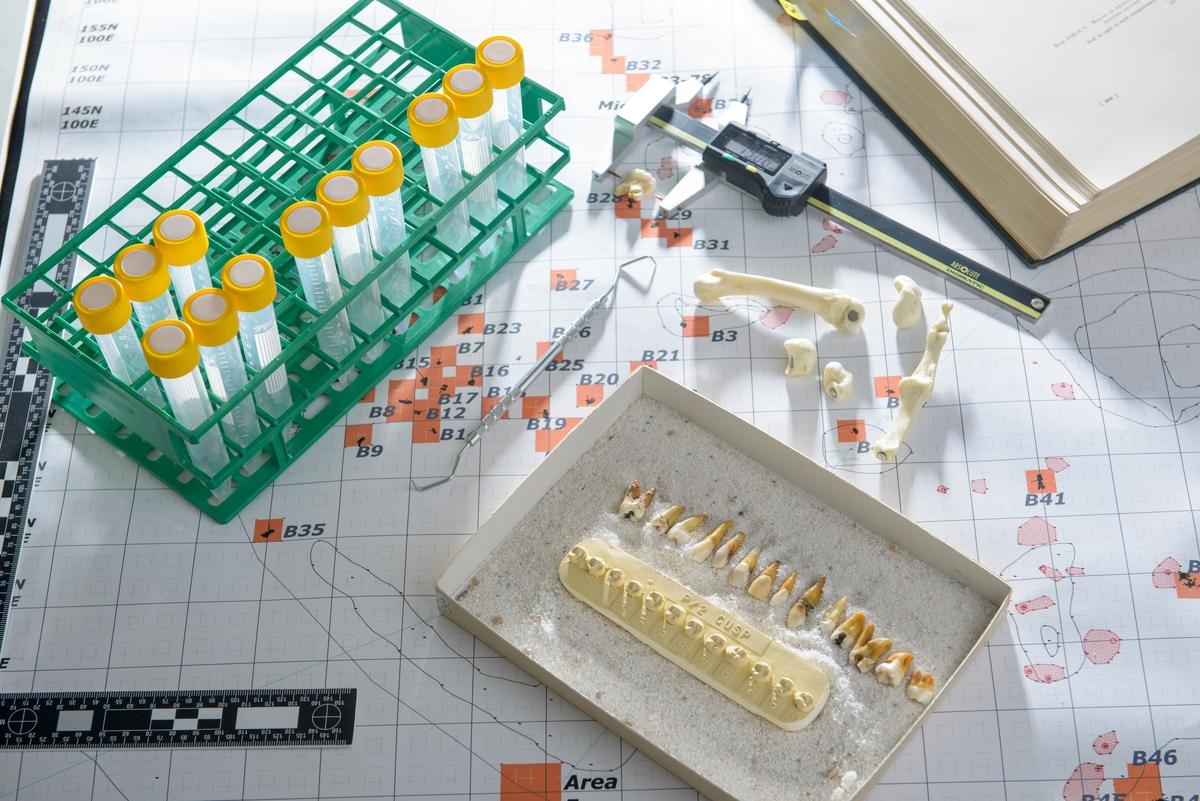 Photo of lab table with vials, teeth casts and tools
